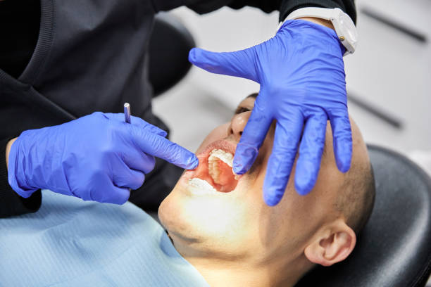 Best Urgent Care for Lost Fillings or Crowns in Sierra Madre, CA